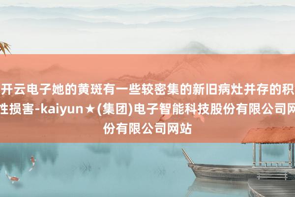 开云电子她的黄斑有一些较密集的新旧病灶并存的积存性损害-kaiyun★(集团)电子智能科技股份有限公司网站